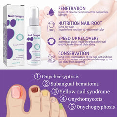 Fungus Spray 100ml Nail Repair Spray