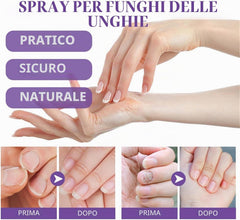 Fungus Spray 100ml Nail Repair Spray