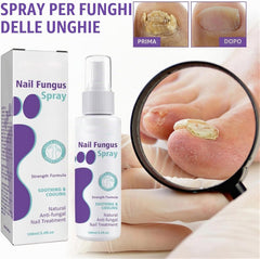 Fungus Spray 100ml Nail Repair Spray
