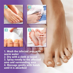 Fungus Spray 100ml Nail Repair Spray