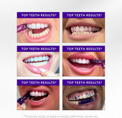 Teeth Whitening Strips